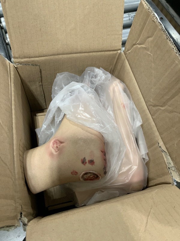 Photo 1 of Ultrassist Diabetic Foot Ulcer Model Set - Anatomical Accuracy for Mild & Severe Stage Pathology Study - Medical Training Tool for Healthcare Professionals