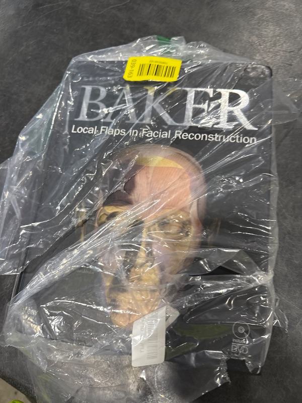 Photo 1 of Local Flaps in Facial Reconstruction: Text with DVD