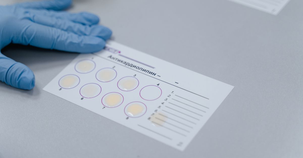 Lab test result form with gloved hand, indicating a scientific experiment setup.