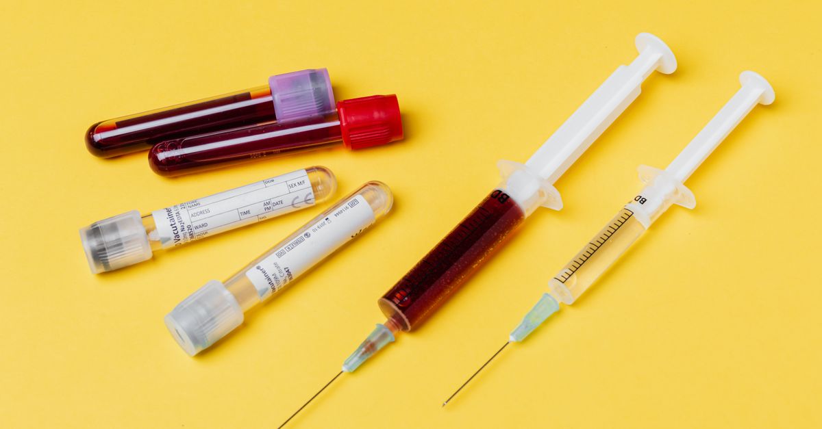 From above of medical syringe with medication near injector with blood sample arranged with filled clinical test tubes placed on yellow background