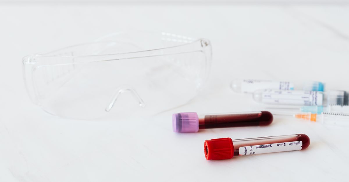 From above plastic eyeglasses and syringes placed near empty and full of blood vials on white surface