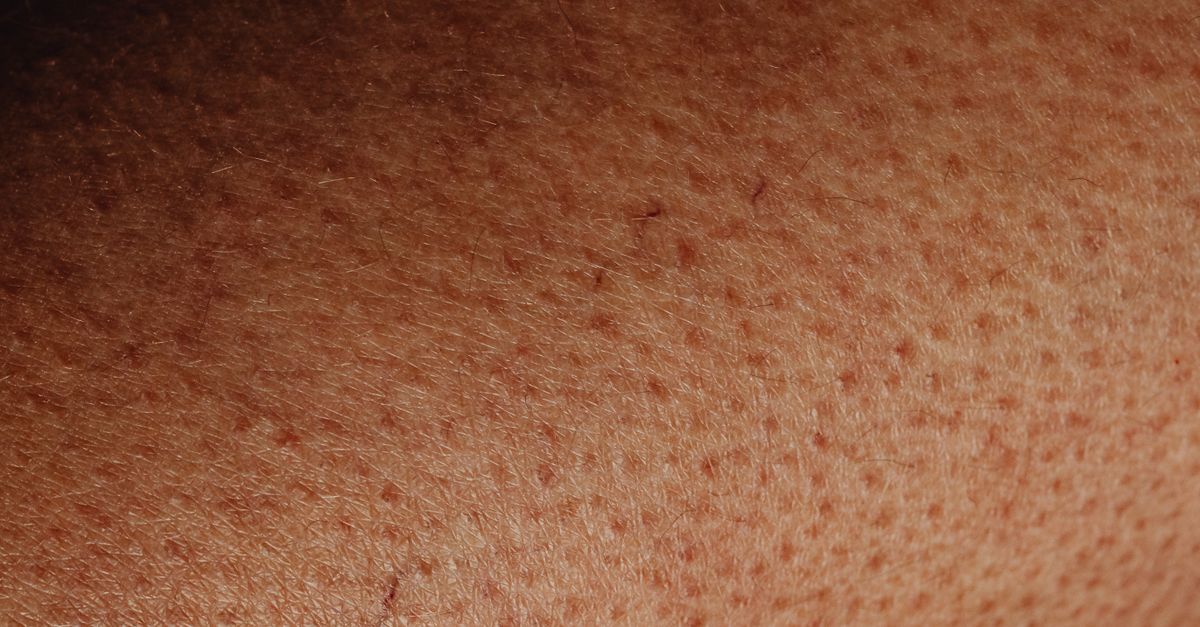 Detailed close-up view of human skin surface showing natural texture and imperfections.