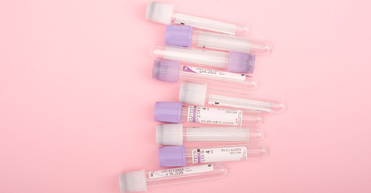 Top view of transparent glass test tubes with stickers placed on pink background