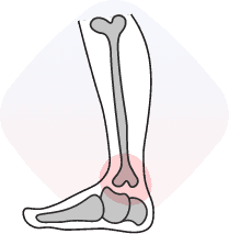 Orthopedics - Bones, Joints Issues