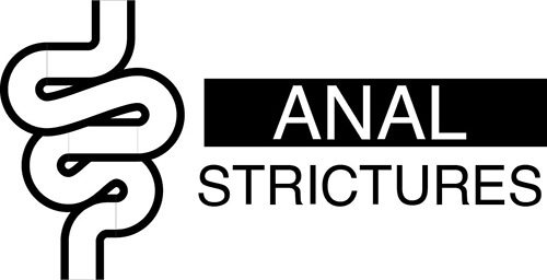 Strictures
