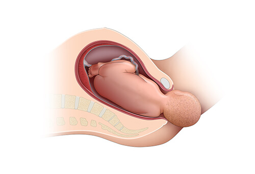 lost vaginal elasticity