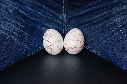 VV genitals