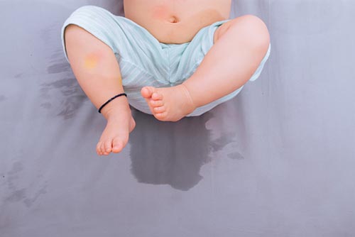 baby having bedwetting problem