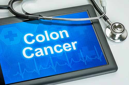 colon cancer in piles