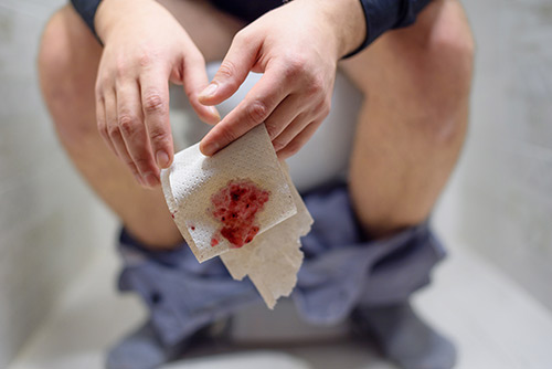 bleeding in piles