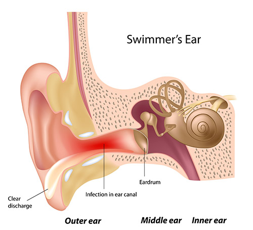 Ear disorder, ENT treatment