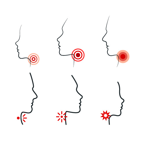 an image showing the pain areas after tonsil treatment