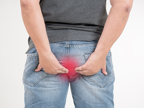 pictorial representation of a boy having an anal fistula symptoms