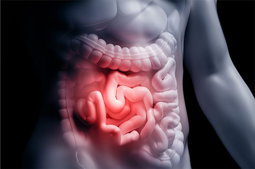Intestinal problem