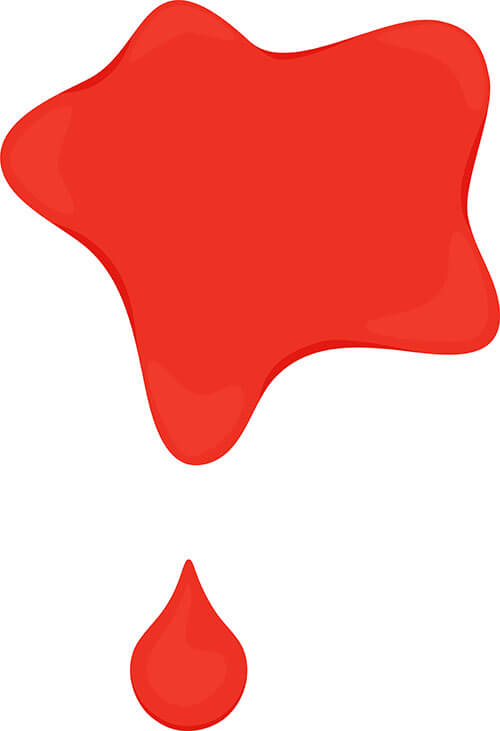 Bleeding after gallbladder removal