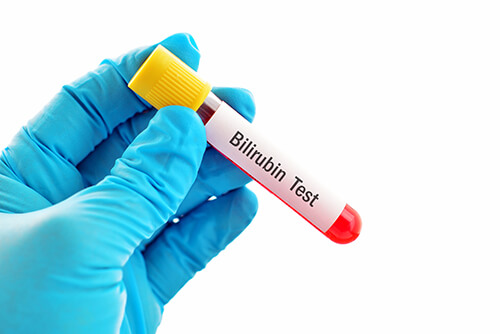 much bilirubin produced