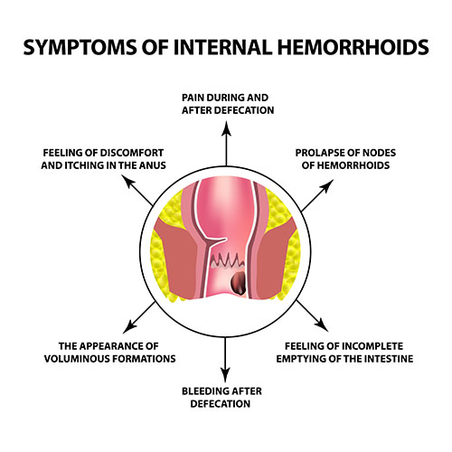 Internal piles