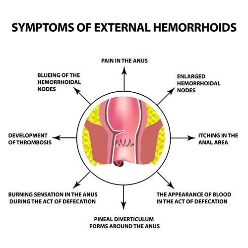 External symptoms