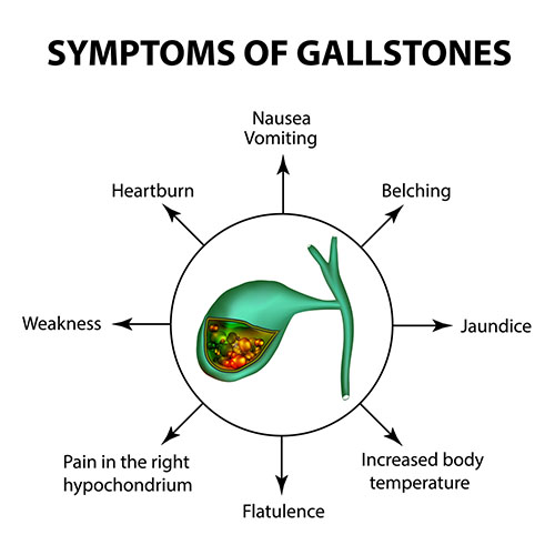 Symptoms of gallstones