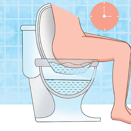 know when to take a sitz bath