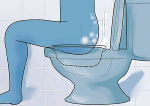 How to take a sitz bath