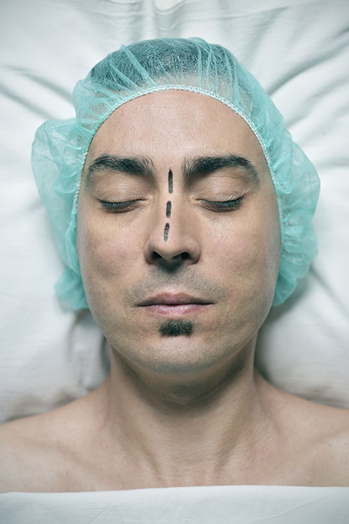image of a patient ready to undergo the surgery