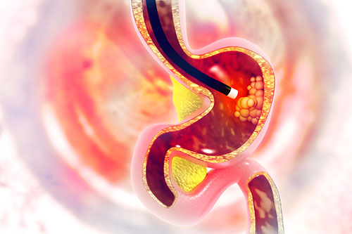the inside of the stomach