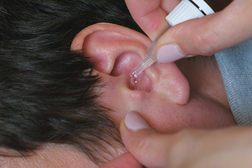 a patient of swimmers ear using the application of ear drops