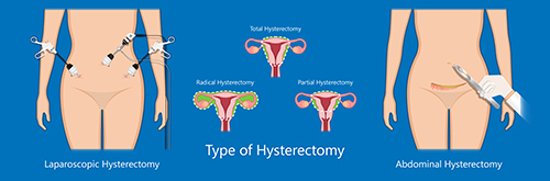 Surgical procedures