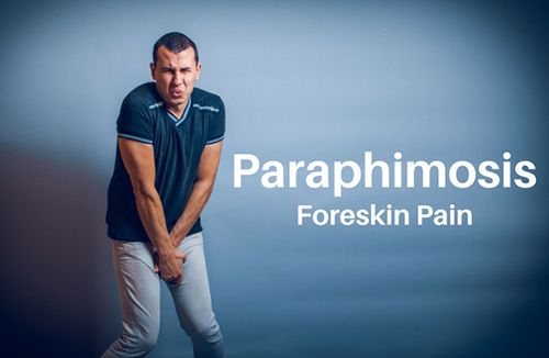 paraphimosis treatment