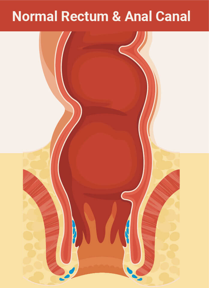 pictorial views of normal rectum anal canal