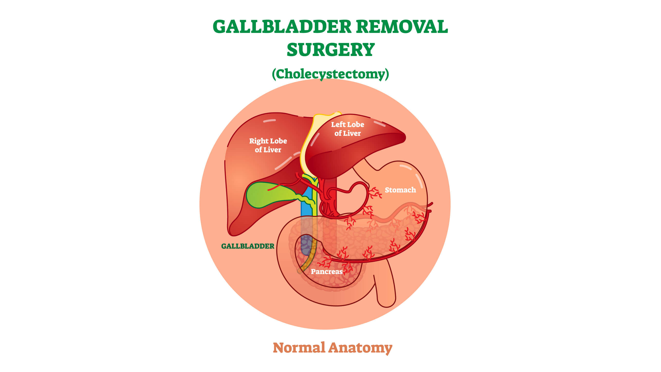 stomach for Cholecystecomy