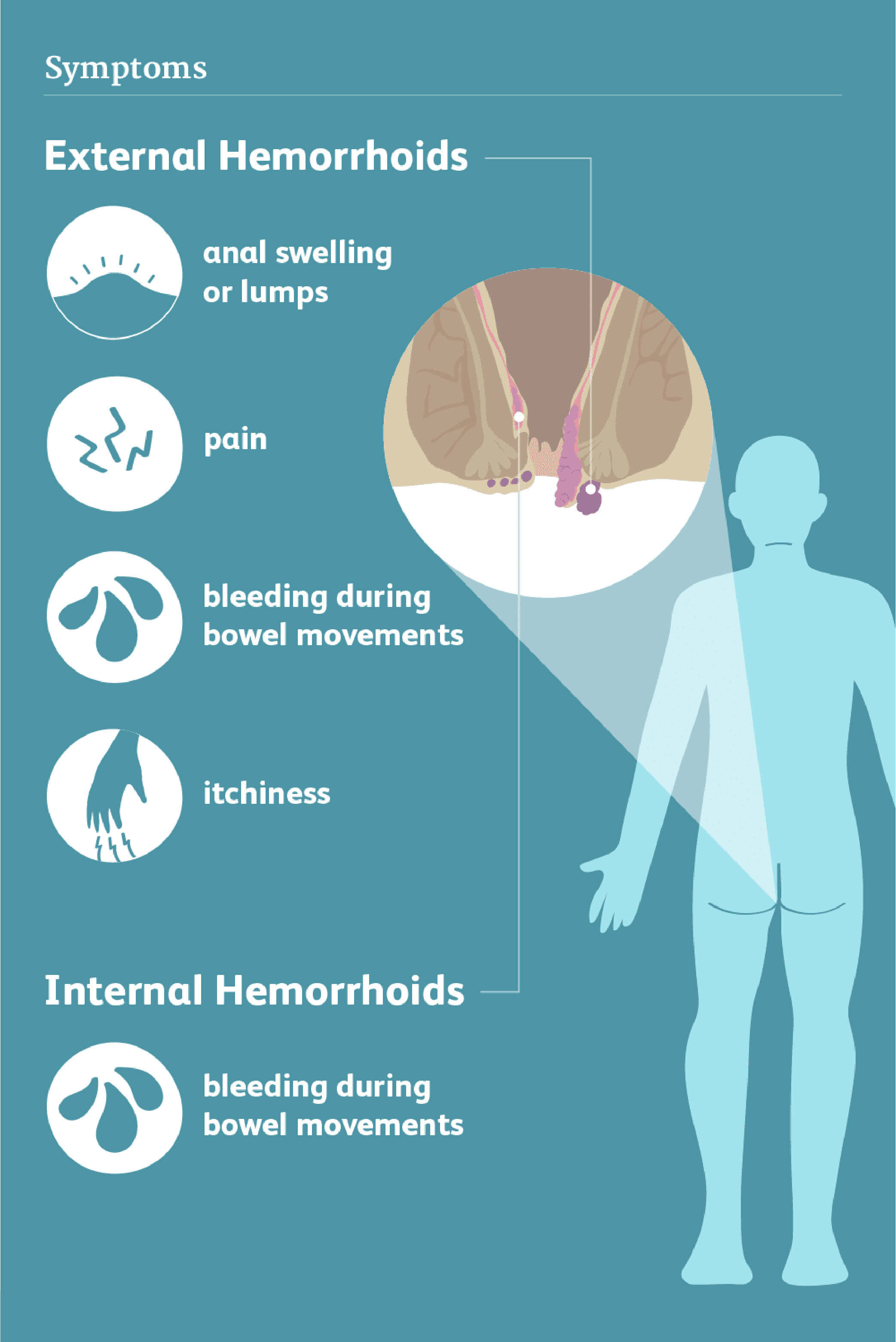 symptoms and labeled piles image