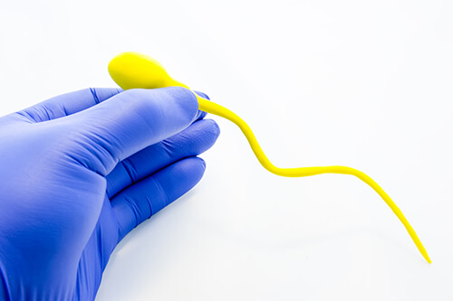 Sperm antibodies
