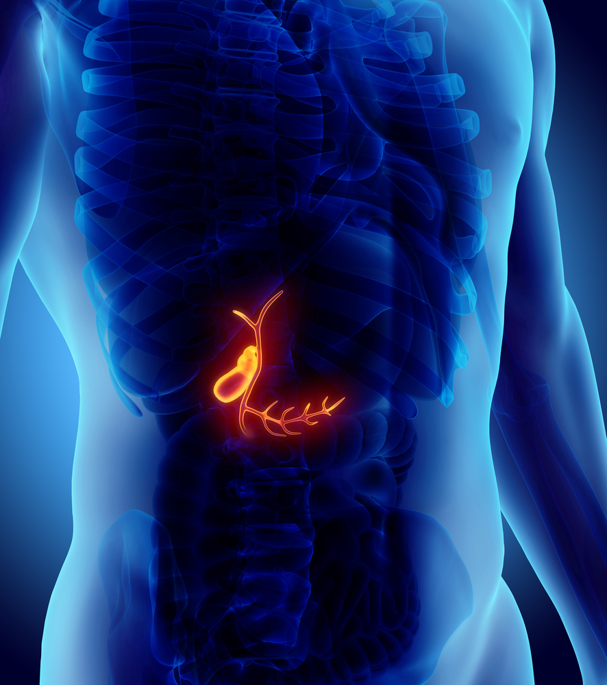 Causes of gallstones