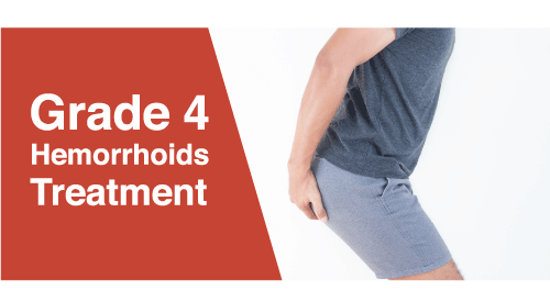 level 4 piles laser treatment