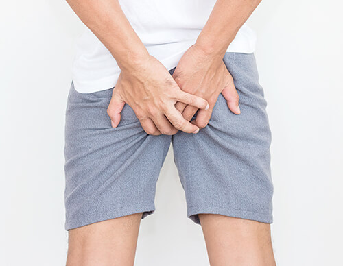 pictorial representation of anal disease or problem