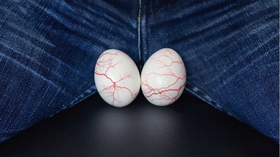 Hydrocele Causes, Symptoms, Treatment and Prevention