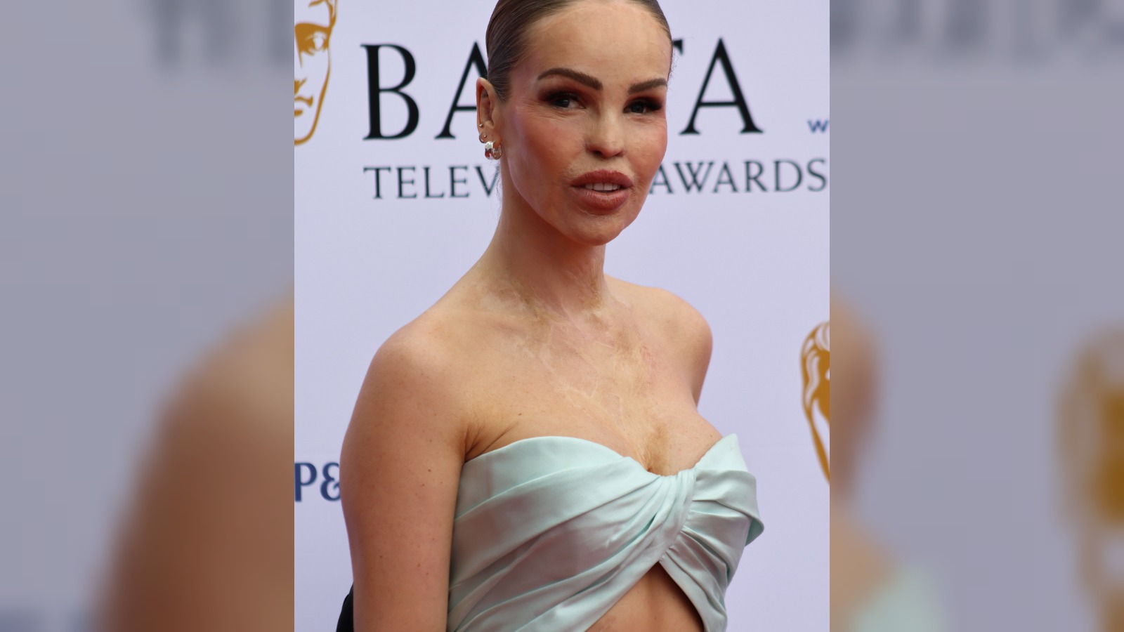Katie Piper condemns trolls using AI to alter her face