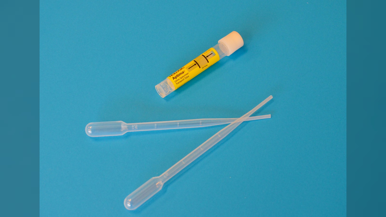 New home urine test spots over 9 in 10 bladder cancers