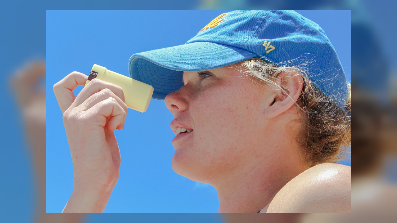 Sunscreen can sting due to alcohol or specific UV filters