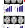A skill becomes automatic as the brain rewires itself to bypass its own bottleneck, new study suggests