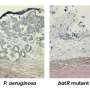 Biofilm clue opens route to anti-infection treatments of the future