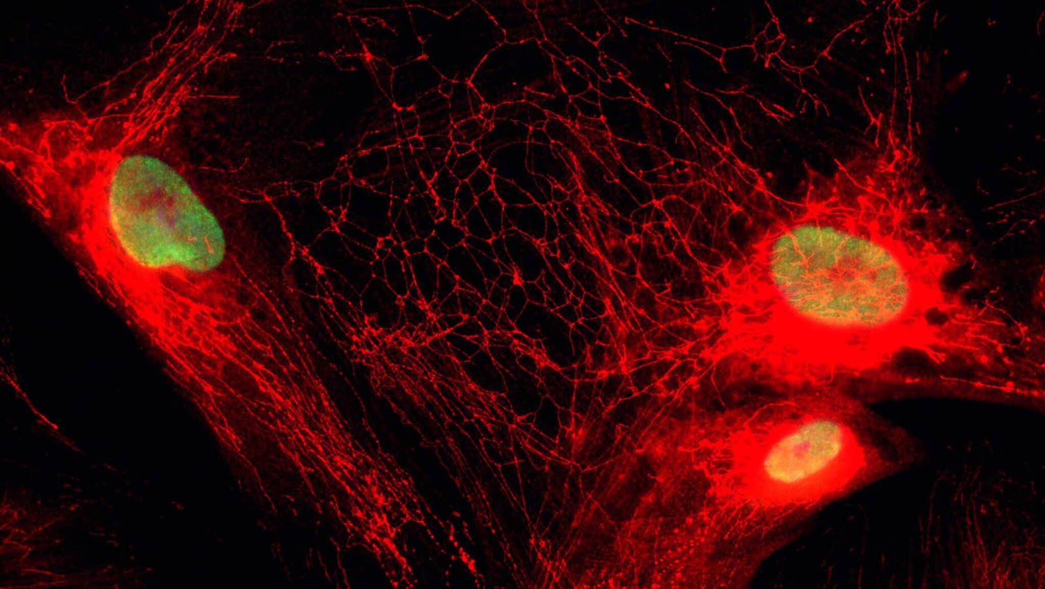 Blocking a mitochondrial transporter may curb inflammation from 'zombie' cells without killing them