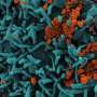 Gonorrhea's own enzyme triggers therapy against multidrug-resistant strains in lab tests