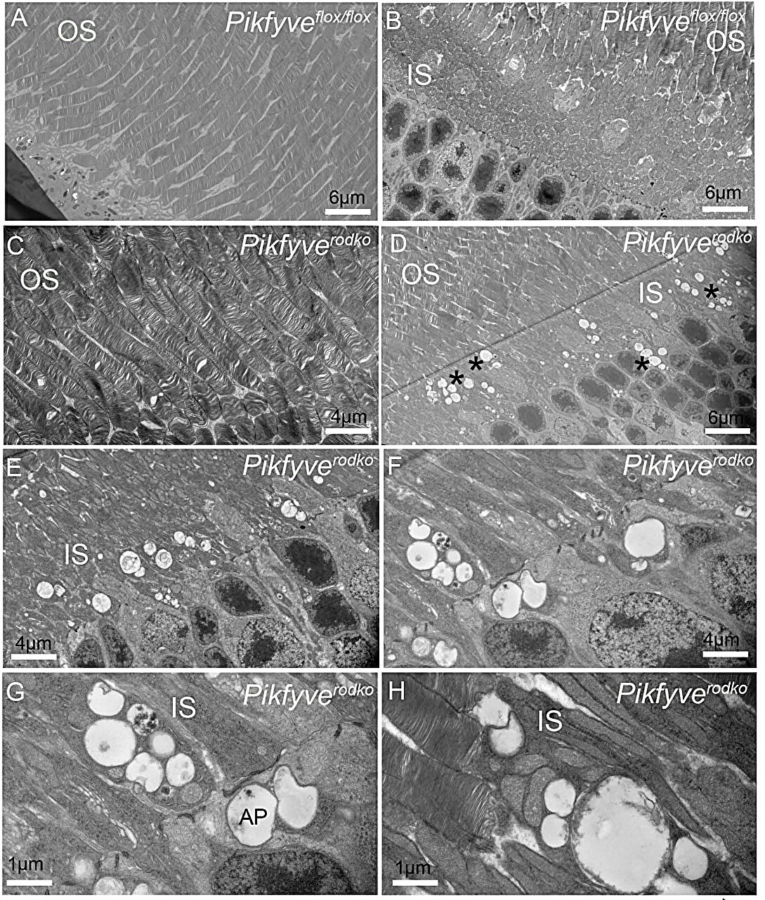 Hidden 'recycling system' helps keep vision cells healthy
