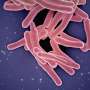 Hundreds of people in England have died before doctors diagnosed their tuberculosis