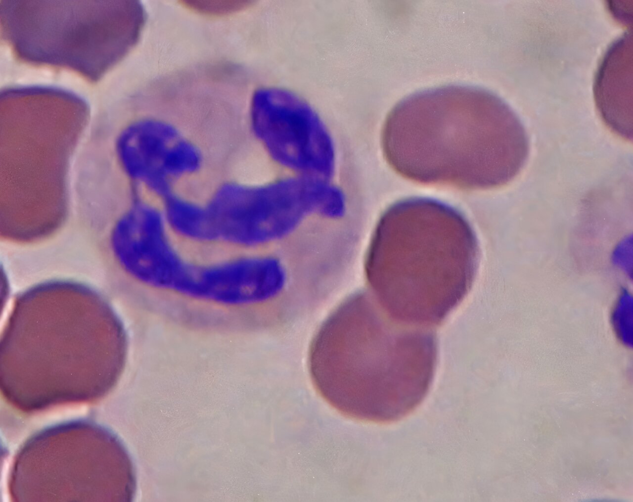 Immune navigation system discovery could lead to better treatments for chronic inflammation