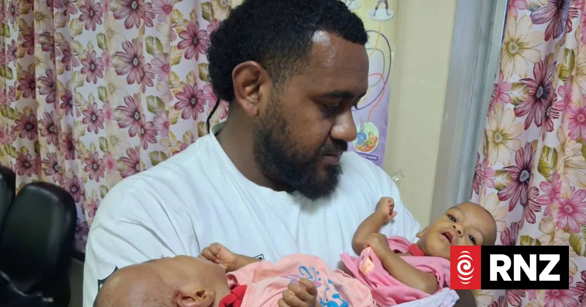 Three countries asked for $1 million - then Saudi Arabia stepped in with free surgery for rare conjoined twins