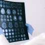 Two post-surgery blood–brain disruption windows may offer glioblastoma treatment targets